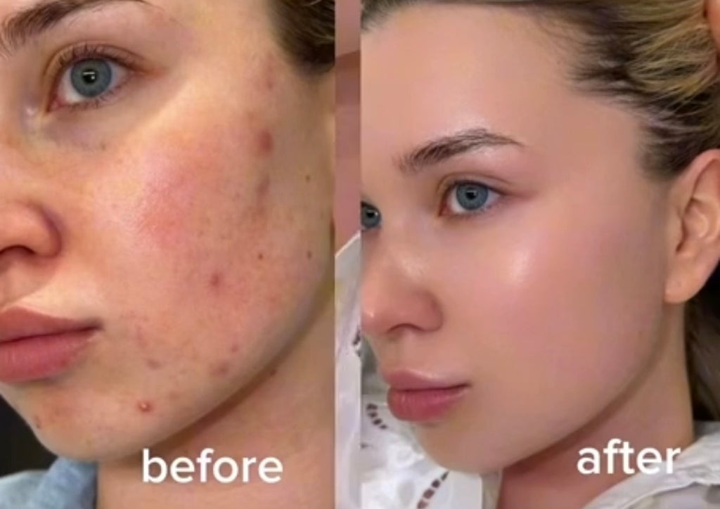 The Daily Glow Ritual Dark Spot Cream