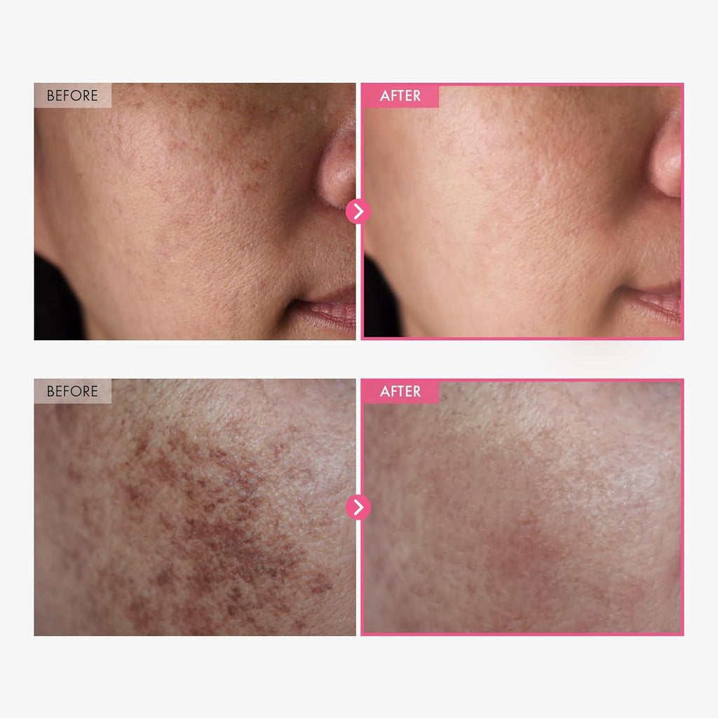 The Daily Glow Ritual Dark Spot Cream